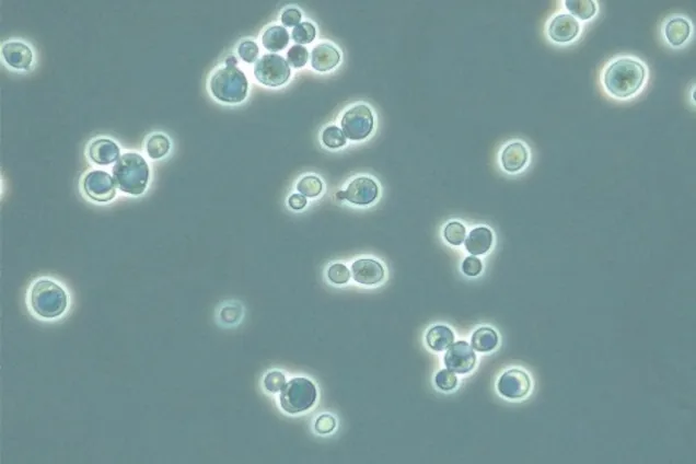 Yeast cells in a microscope. Photo.