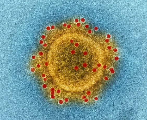 Digitally colorized transmission electron microscopic (TEM) image. Photo.