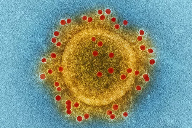 Mänsklig cell som attackeras av virus. Foto.